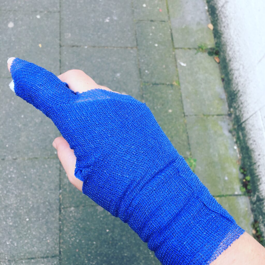 geschienter Finger